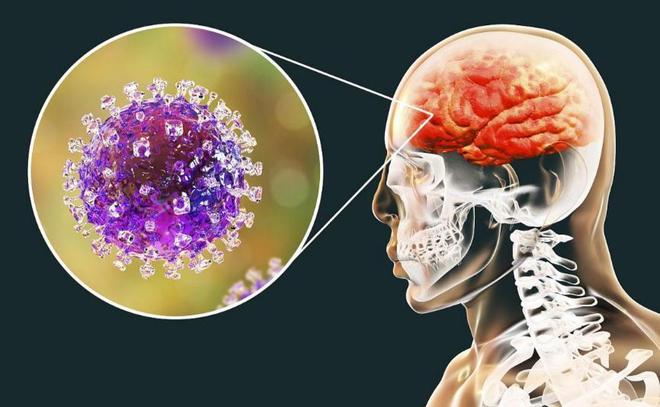 印度尼帕病毒中国应对措施_尼帕病毒疫情春运防控_疫情