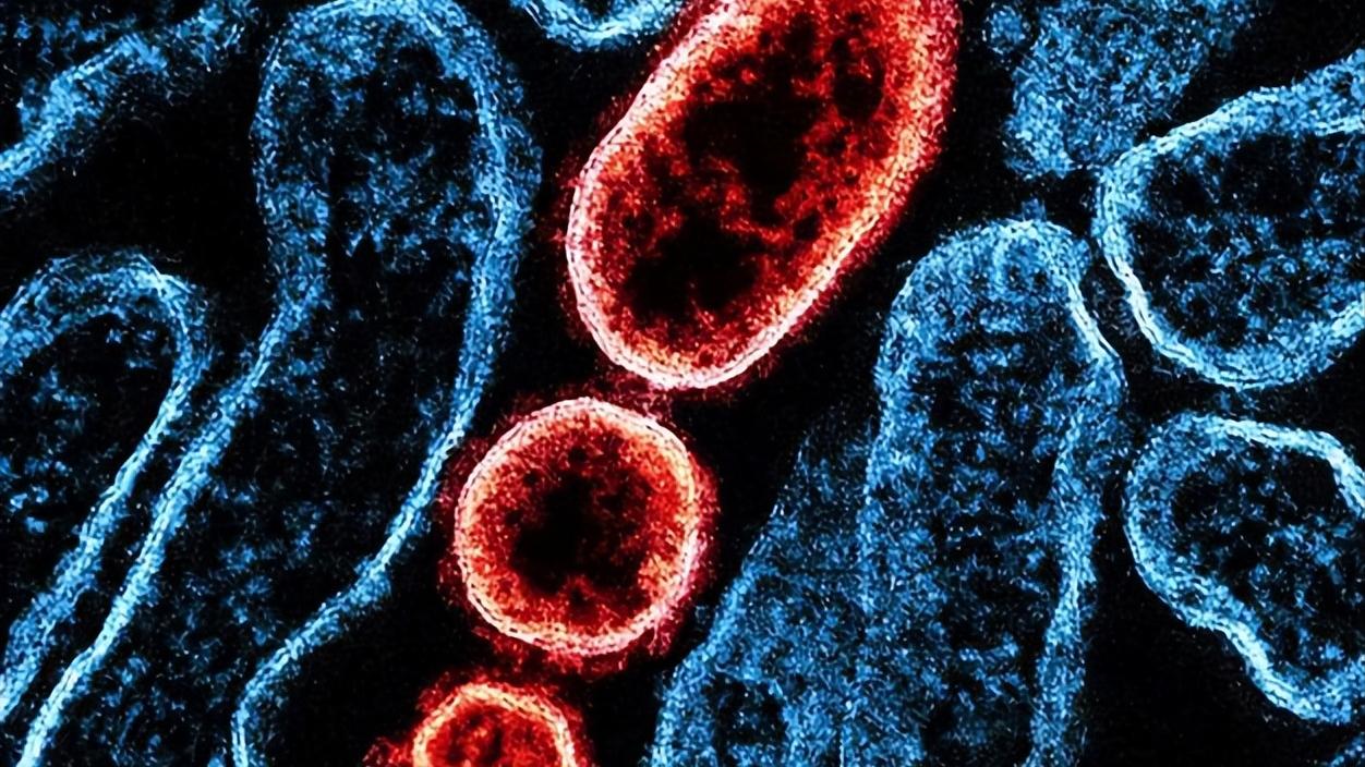 疫情_尼帕病毒是什么 防止尼帕病毒感染 家庭常备防疫物资